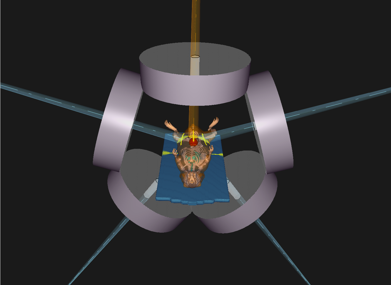 Planning in &micro;-RayStation.png